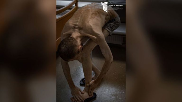 Photos of released Ukrainian prisoners of war show emaciated bodies in ‘horrifying’ condition